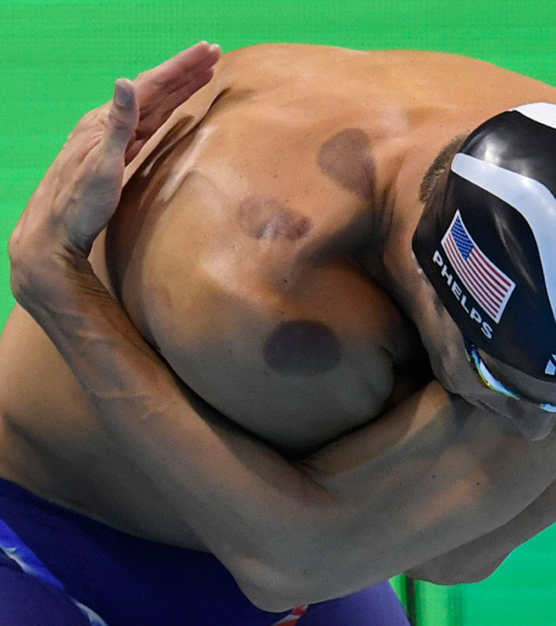 Phelps ha recurrido al 'cupping' en Río 2016